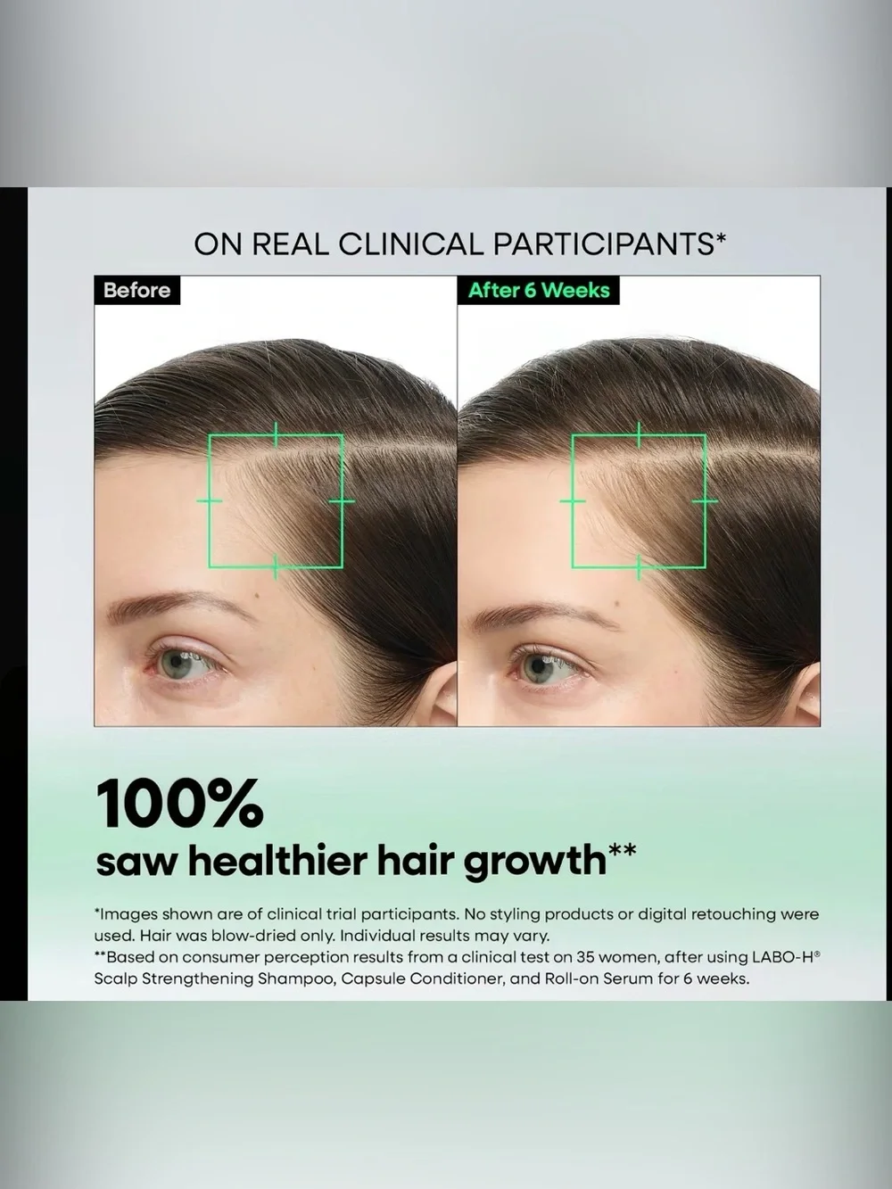 LABO-H DUO Scalp strengthening shampoo/ strengthening roll on serum KoreanHair